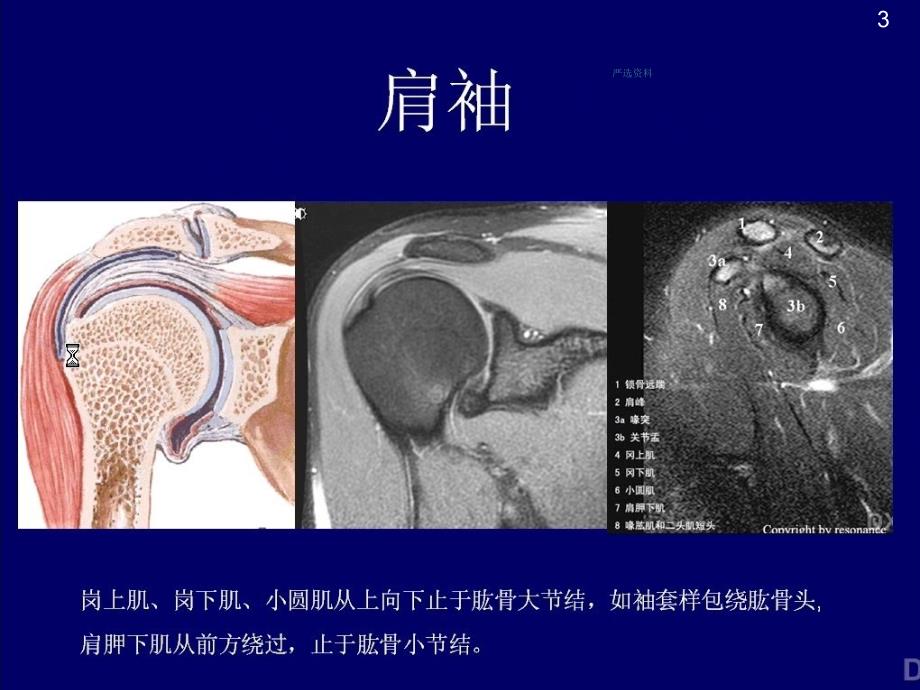 肩关节MRI影像诊断（行业荟萃）_第3页