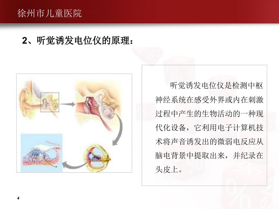 脑干诱发电位—刘军讲解_第4页