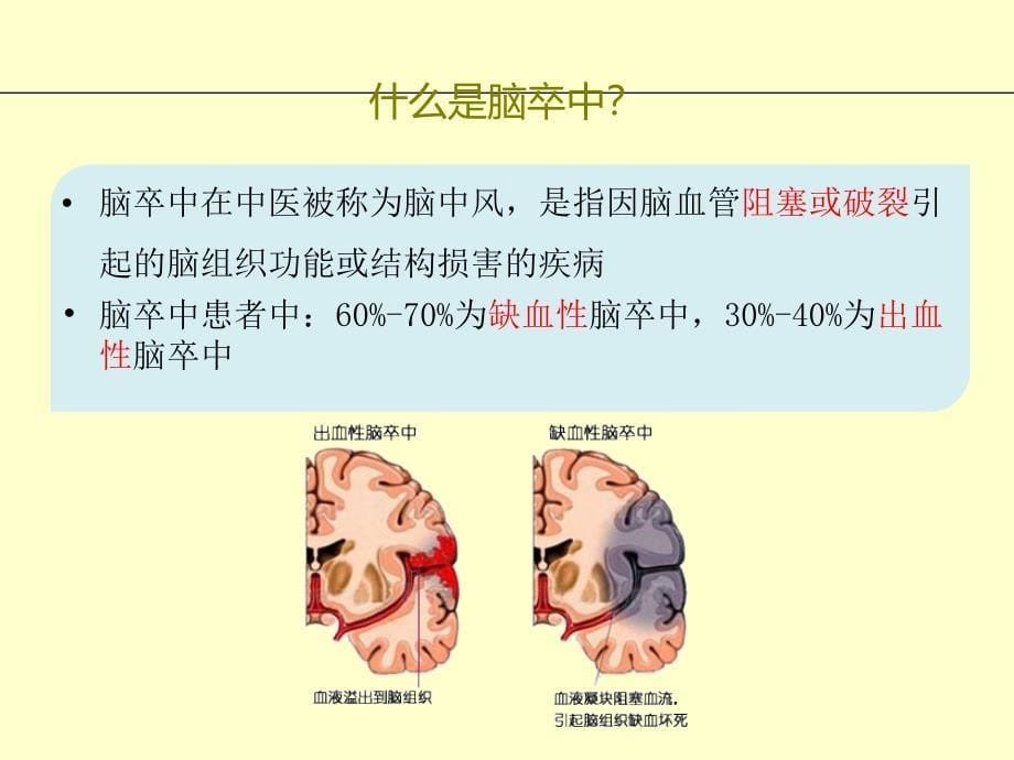 脑卒中健康宣教_第5页