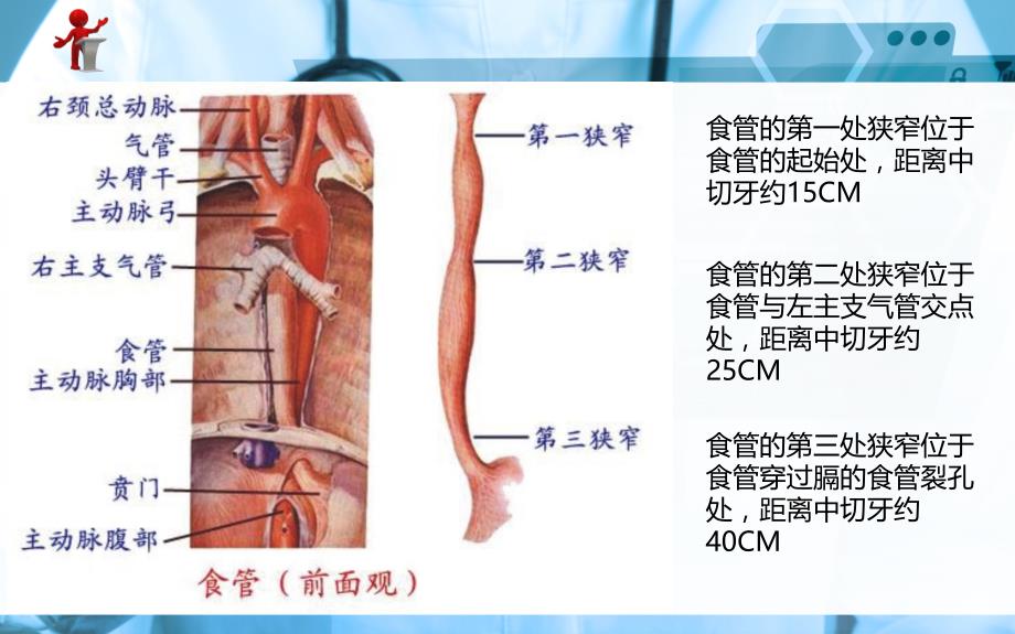 《外科护理》第十三章-第四节-食管癌病人的护理幻灯片_第2页