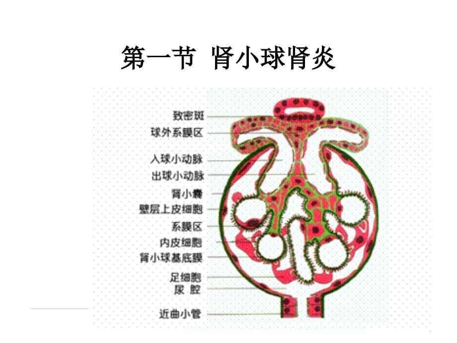 泌尿系统常见疾病病理生理学.ppt_第5页