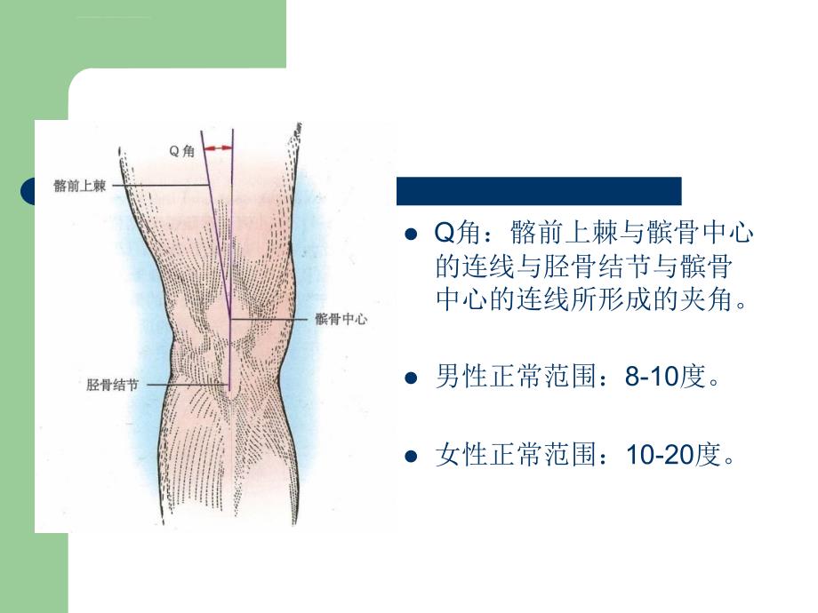 gui习惯性髌骨脱位ppt课件_第4页