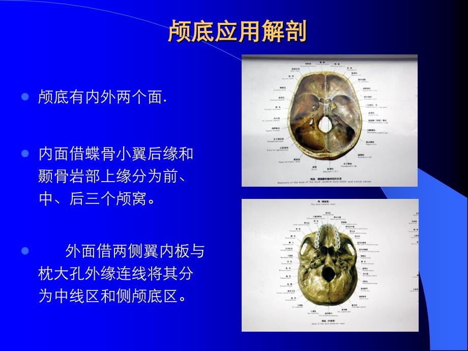 颅底应用解剖课件_第3页