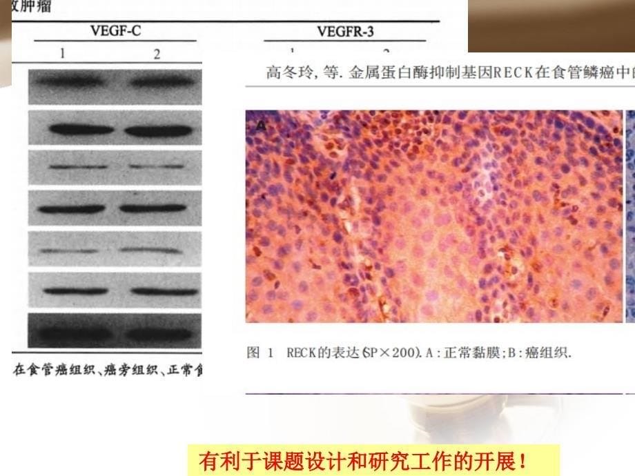 免疫组织化学染色技术20140413_第5页