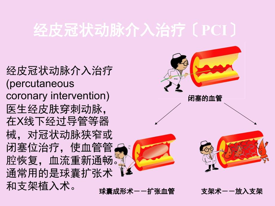 介入术前带教ppt课件_第3页