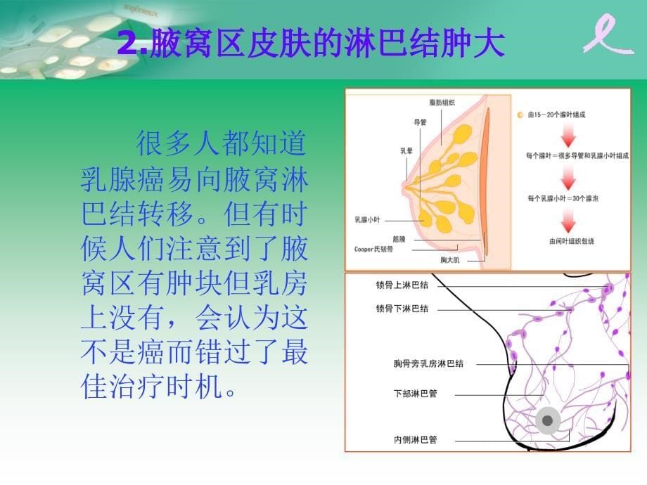 乳腺癌的知识ppt课件_第5页