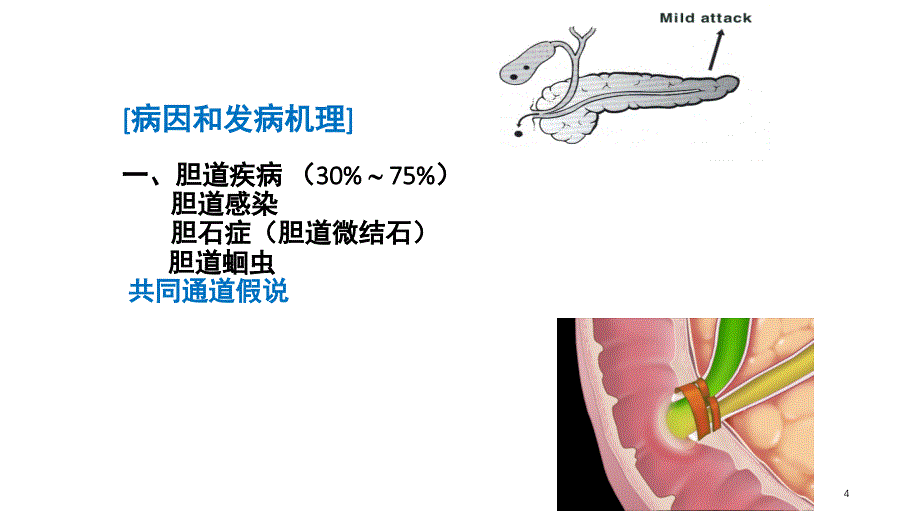 急性胰腺炎的药物治疗文档资料_第4页