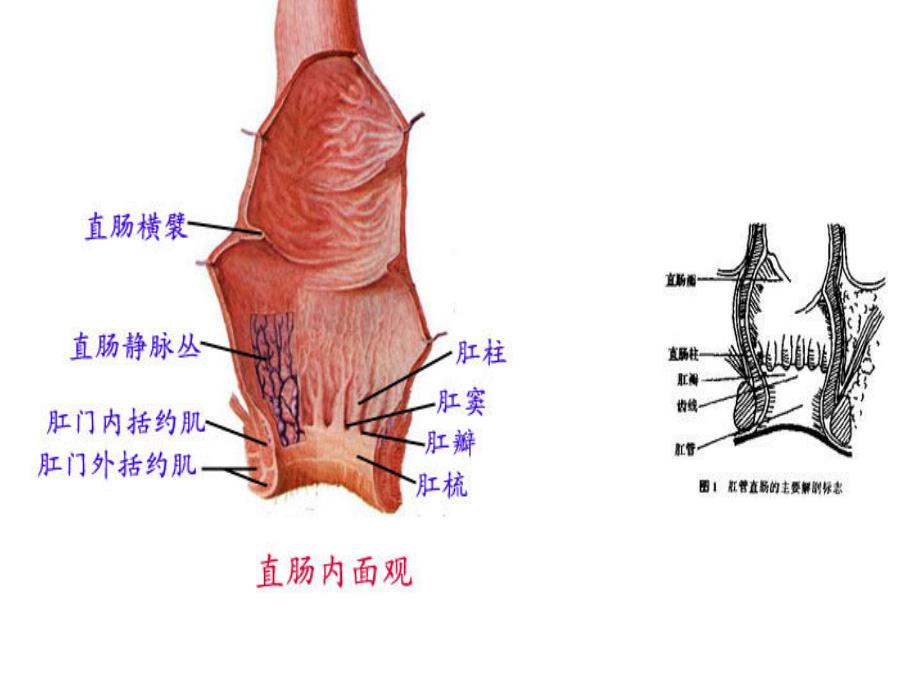 痔疮病人的护理.ppt_第3页