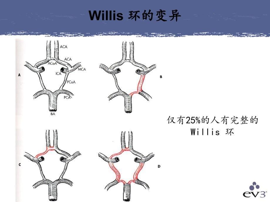 神经介入产品培训课件_第5页