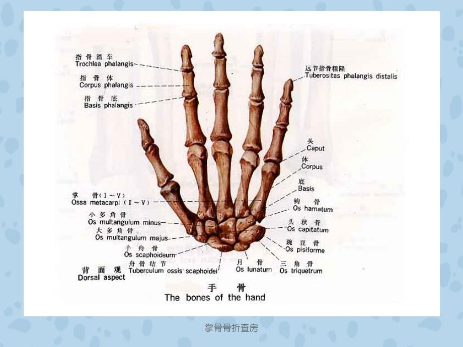 掌骨骨折查房课件_第4页