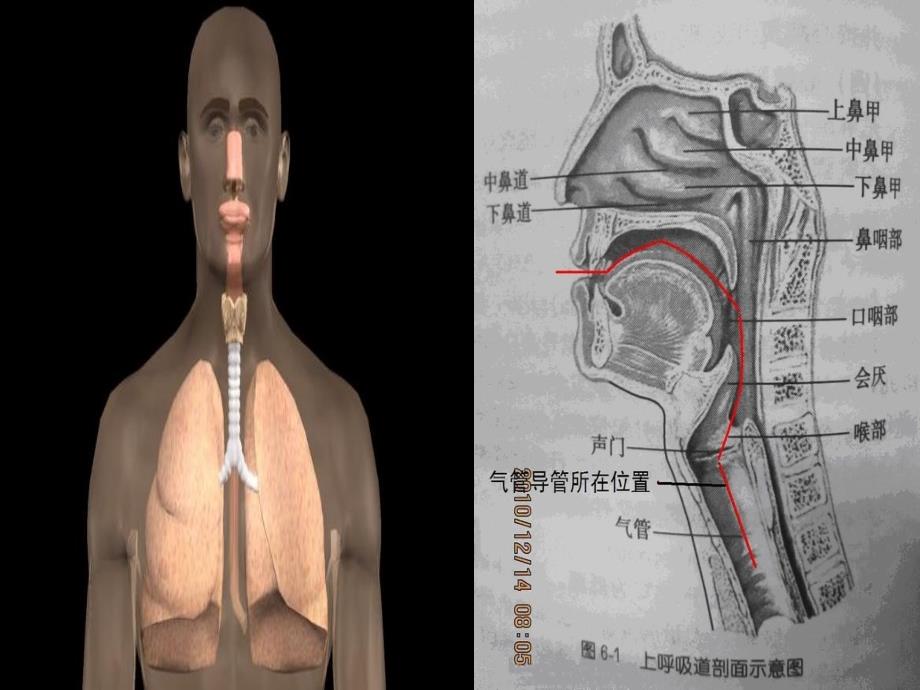 《气管切开病人》PPT课件_第4页