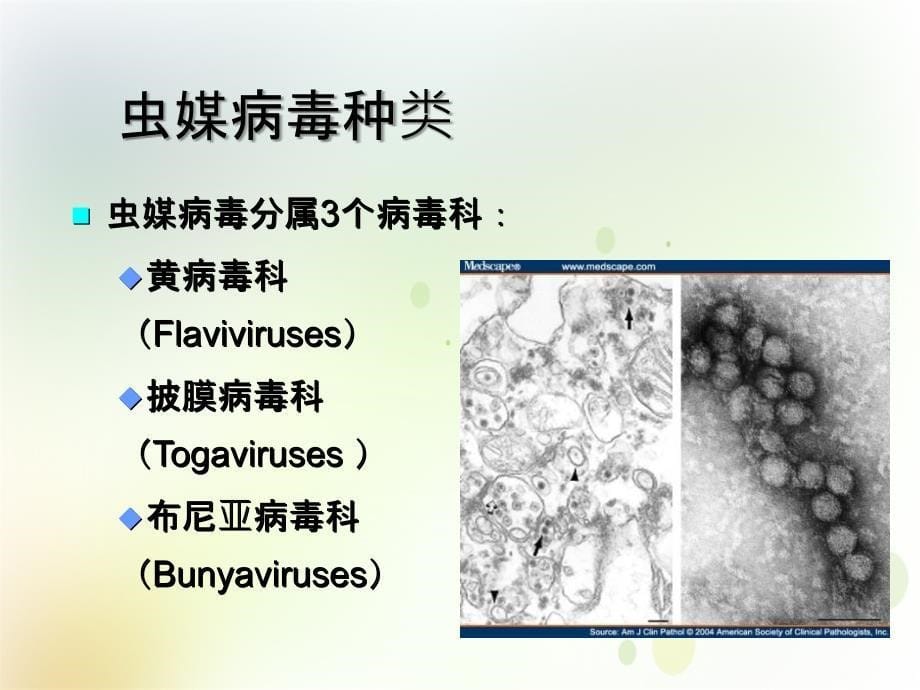 医学微生物学第三篇医学相关病毒第33章黄病毒_第5页