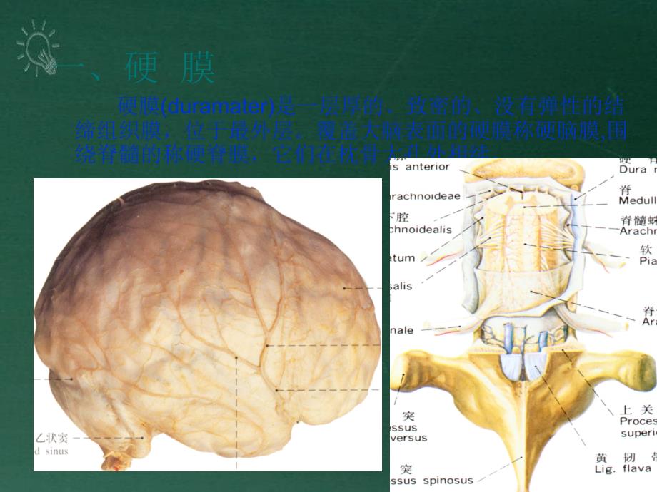 《J脑和脊髓的被膜》课件_第3页