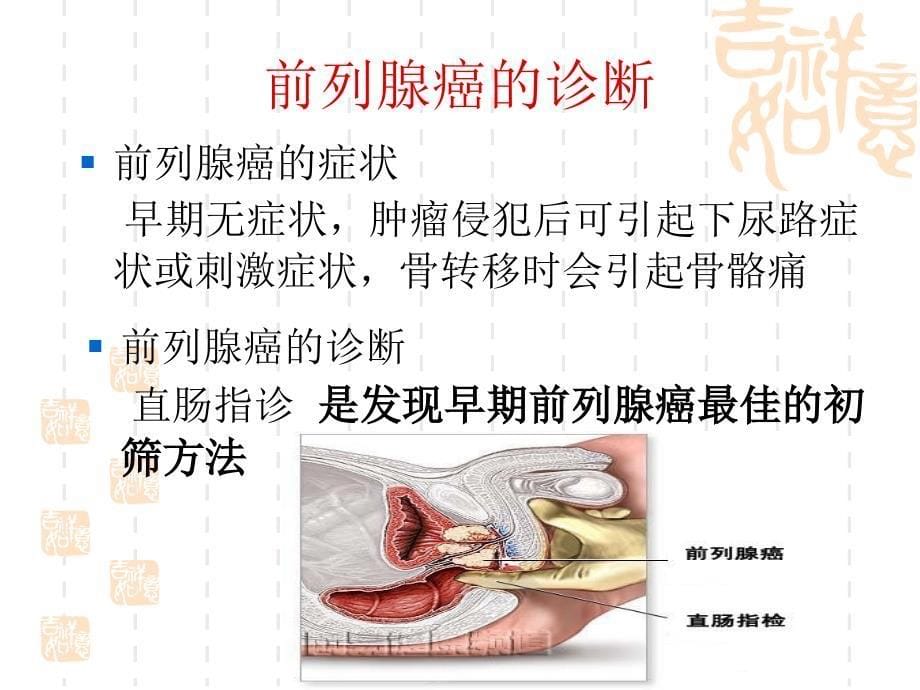 前列腺癌诊疗指南_第5页