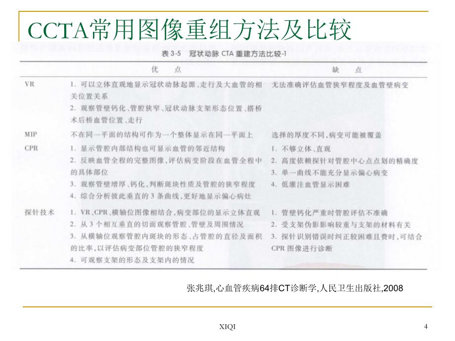 冠状动脉CTA图像判读_第4页