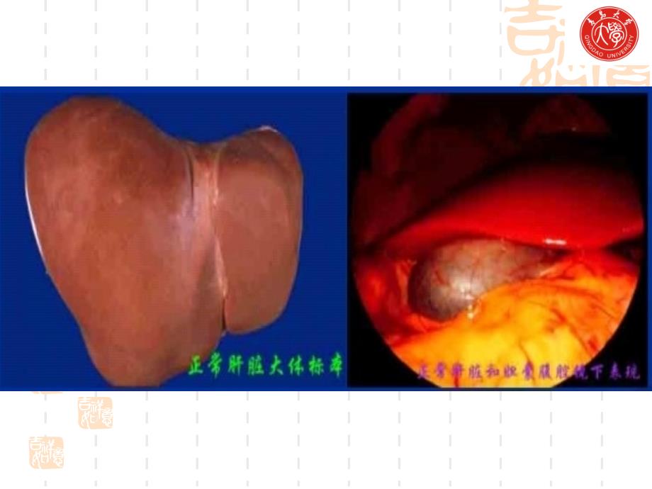 病理生理学课件：第十六章 肝功能不全_第4页