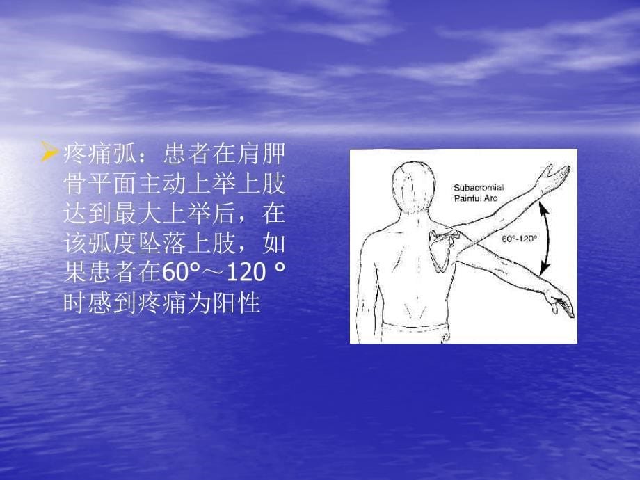 不同程度肩峰下撞击综合征的临床检查准确性_第5页