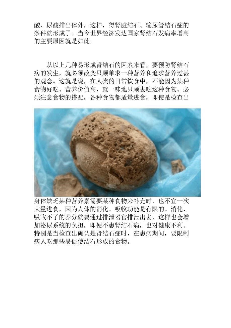 肾结石的饮食保健_第5页