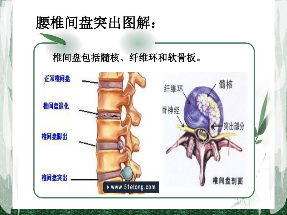 腰椎间盘突出症病人的护理查房(1)讲解学习_第3页