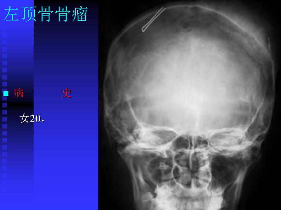 x线学习资料骨肿瘤x线病历图谱11文档资料_第2页