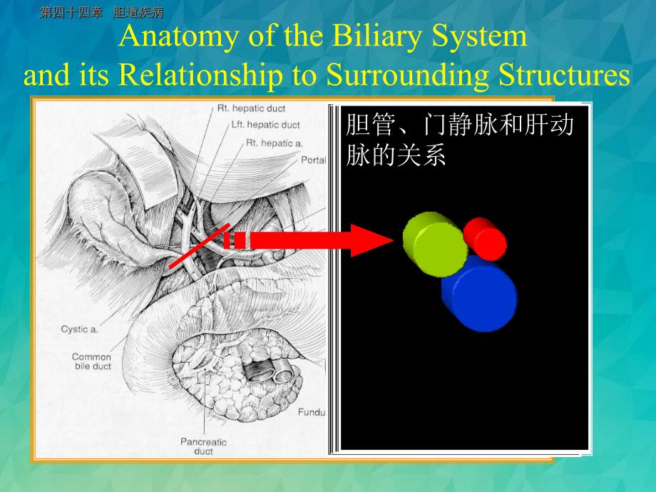 胆道疾病双语课件_第4页