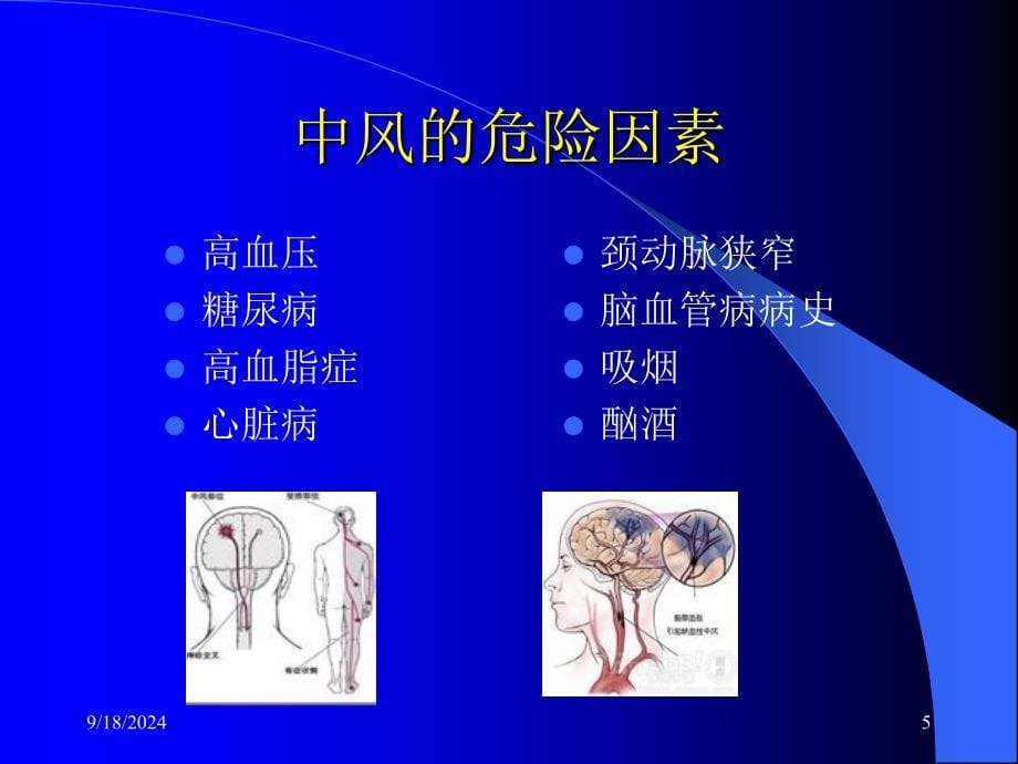 中风患者的康复治疗ppt分析_第5页