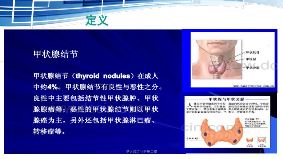 甲状腺结节护理查房课件_第4页