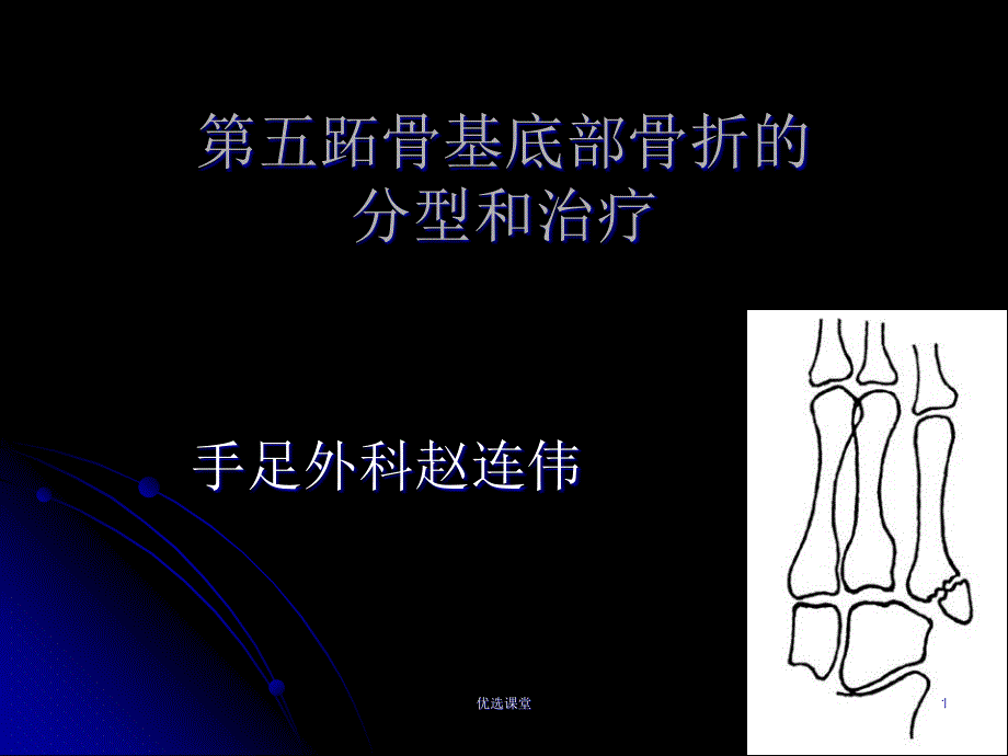 第五跖骨基底部骨折的治疗[讲课适用]_第1页