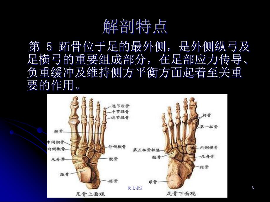 第五跖骨基底部骨折的治疗[讲课适用]_第3页