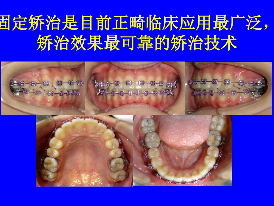 口腔正畸基础学共45页课件_第1页