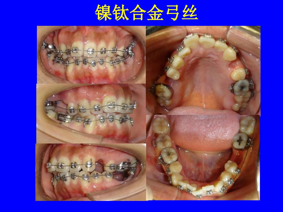 口腔正畸基础学共45页课件_第4页