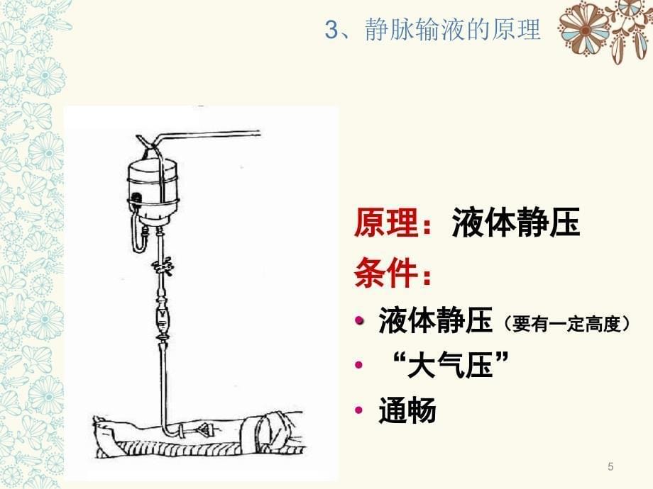 手术室留置针穿刺技术-_第5页