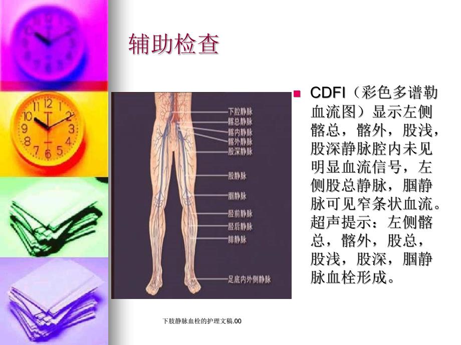 下肢静脉血栓的护理文稿.00课件_第4页