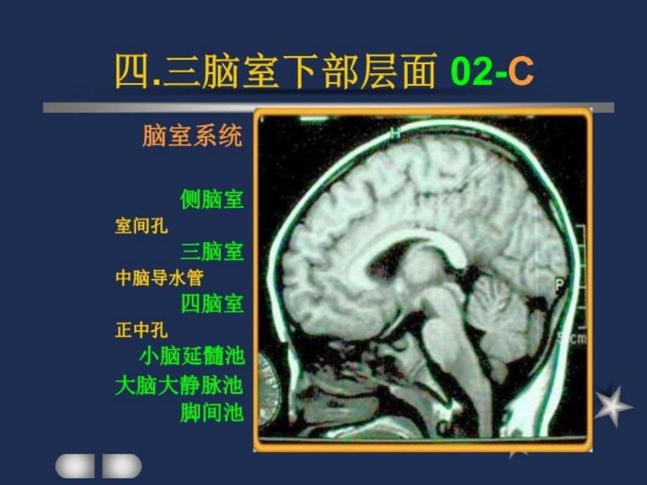 最新四.三脑室下部层面解剖要点精品课件_第4页