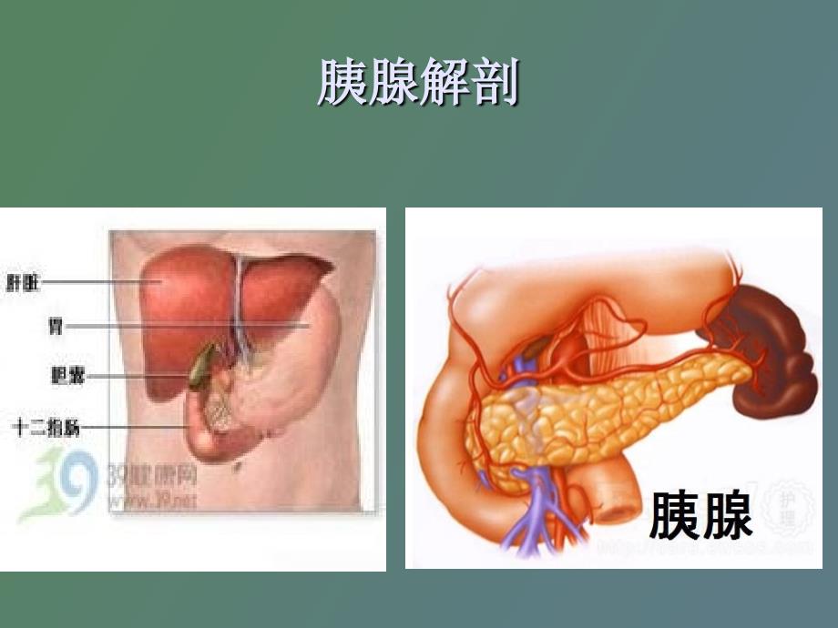 高脂血症性胰腺炎_第1页