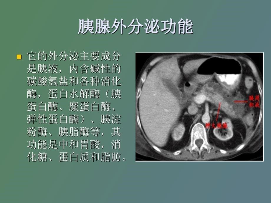 高脂血症性胰腺炎_第5页