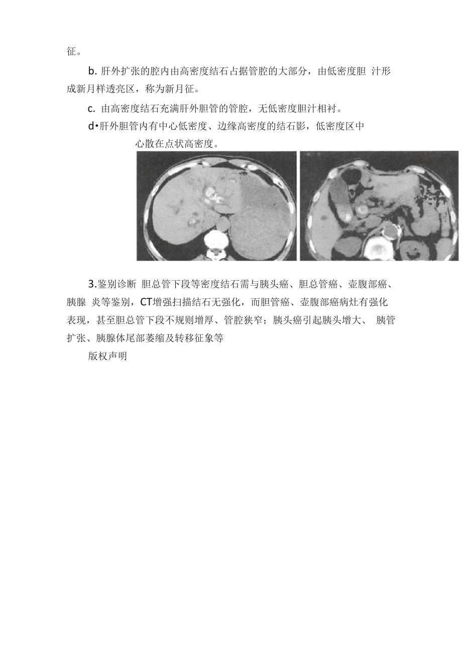 胆囊炎胆囊息肉胆道结石CT分析_第4页