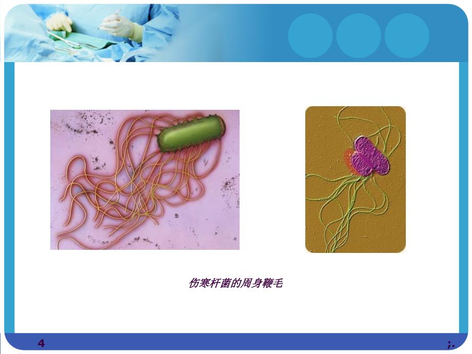 伤寒病人的护理ppt课件_第4页