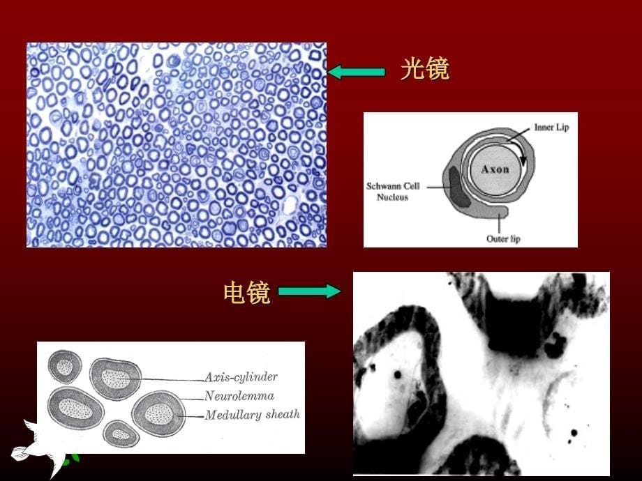 神经传导功能检测在临床的应用_第5页