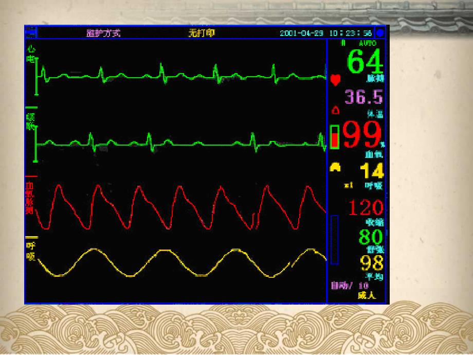 心电监护.PPT_第4页