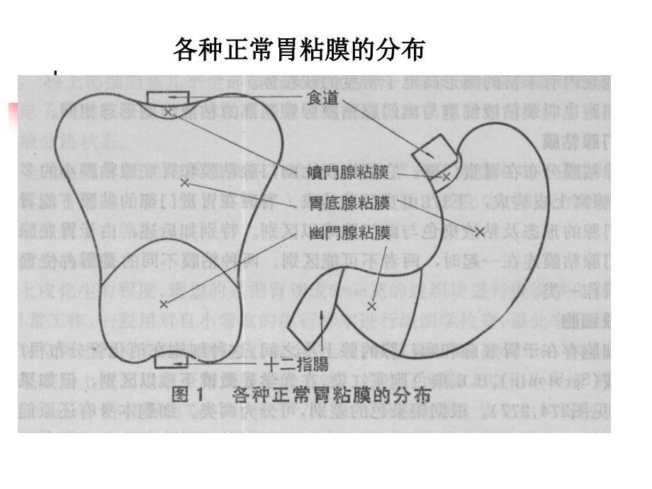 高级病理学：胃肠病理学_第3页