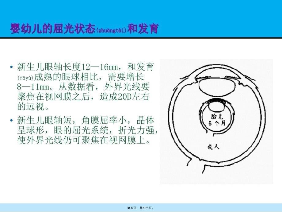 屈光不正1.课件_第5页