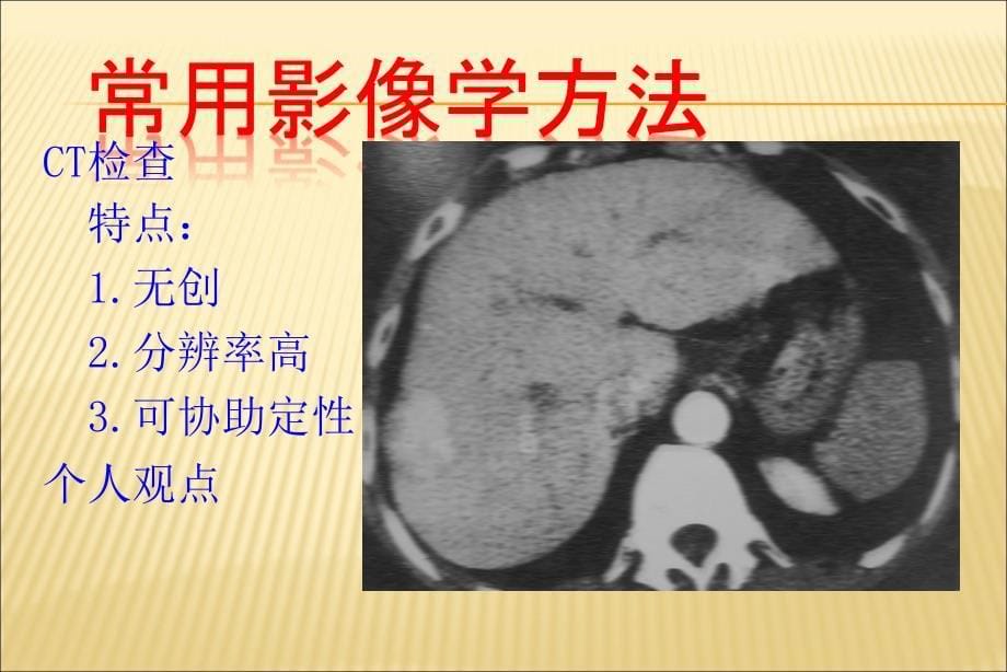 肝癌介入治疗方法课件_第5页