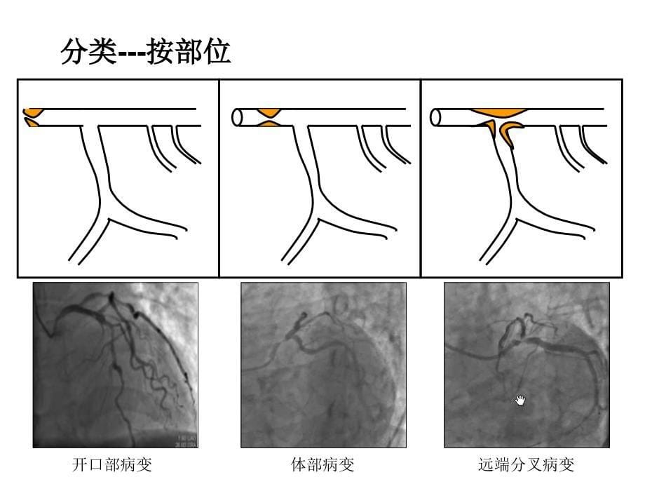 廉哲勋左主干 ppt课件_第5页