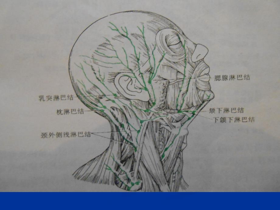 浅表淋巴结的超声诊断(2)教程文件_第3页