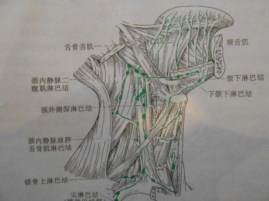 浅表淋巴结的超声诊断(2)教程文件_第4页