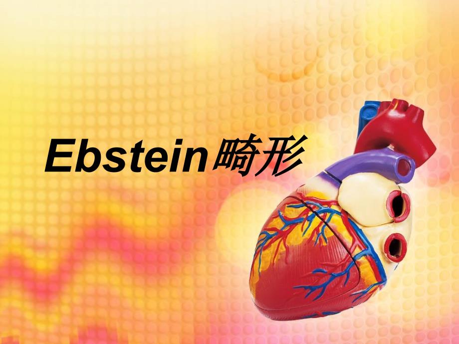 Ebstein畸形三尖瓣下移畸形_第1页