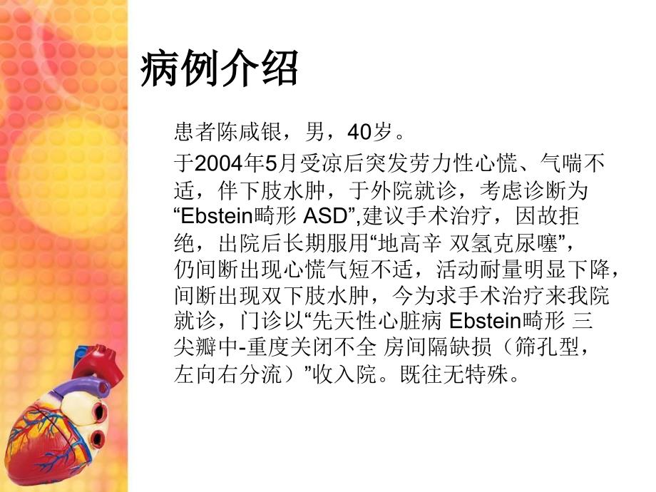 Ebstein畸形三尖瓣下移畸形_第2页