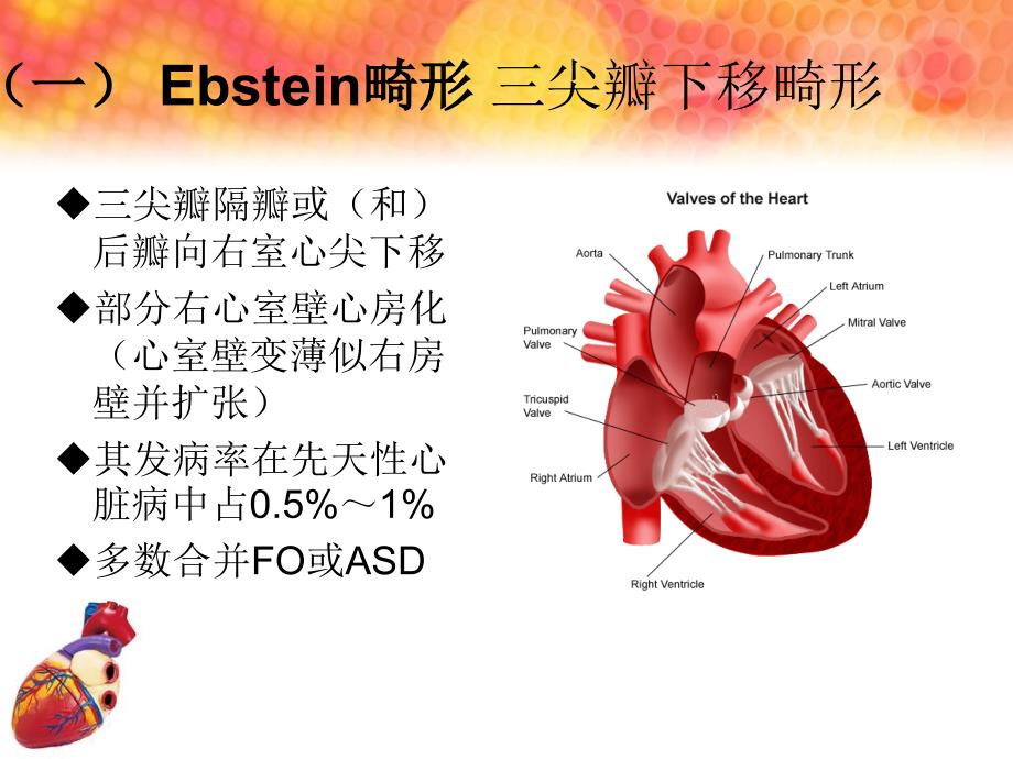 Ebstein畸形三尖瓣下移畸形_第4页