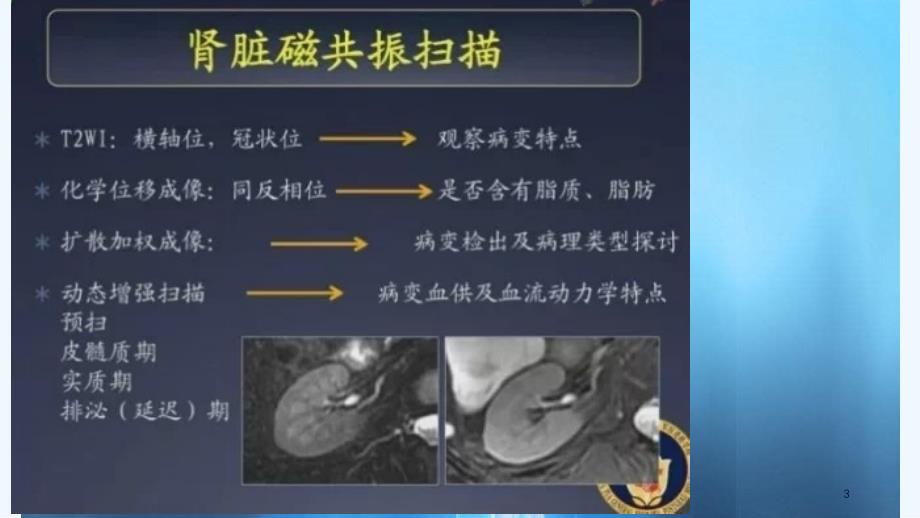 肾细胞癌MRI诊断及鉴别诊断实用课件_第3页